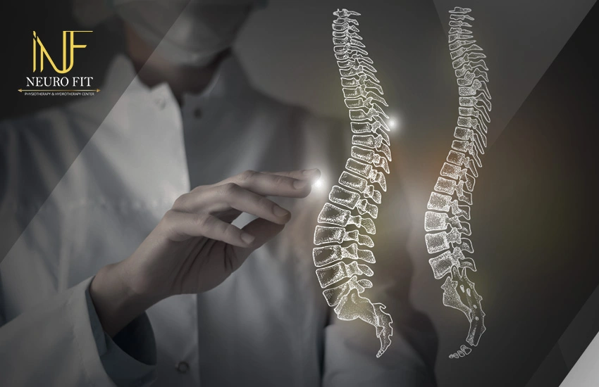 علاج اعوجاج العمود الفقري عند الكبار
